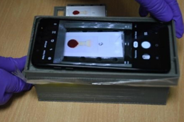 Diagnostics